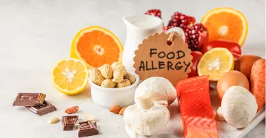 Level 2 Food Allergen Awareness course